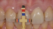 前牙美学分析与设计之二：上中切牙临床冠的宽长比