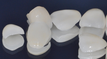 牙科全瓷材料的分类与临床应用（一）