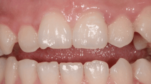 前牙开合的前世今生（四）-关节因素
