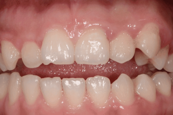 牙齿美学修复临床实用技术